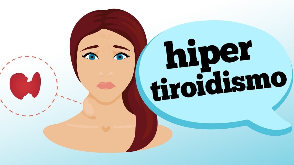 Quais são os sintomas do hipertireoidismo Portal Campo Alegre